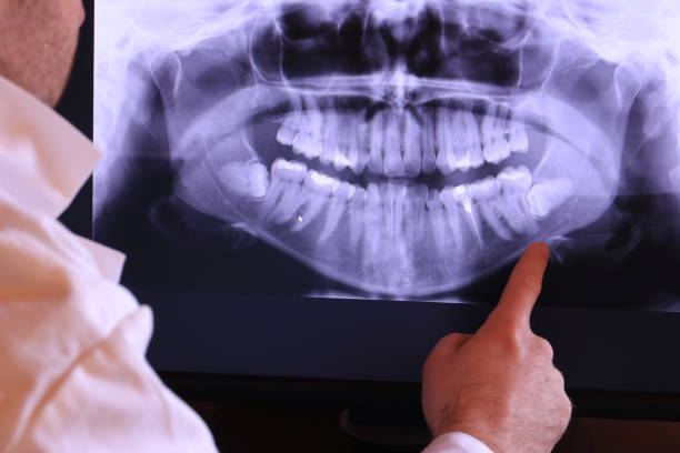 Best Dentist for Tooth Abscess  in Chester, WV